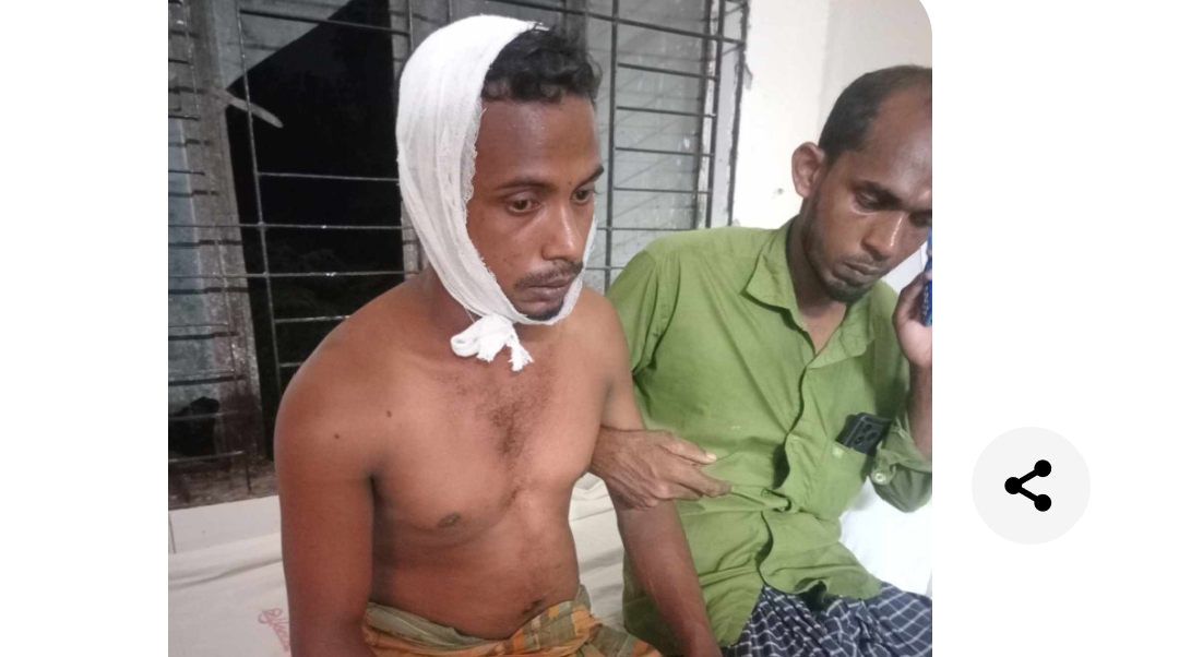 ভগ্নিপতির হাতে ছুরিকাহত হয়ে আহত শ্যালক শামিম