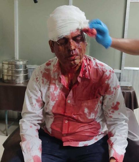 চট্টগ্রামে জিয়া মঞ্চ নেতাকে কুপিয়েছে ছাত্রলীগ ক্যডার
