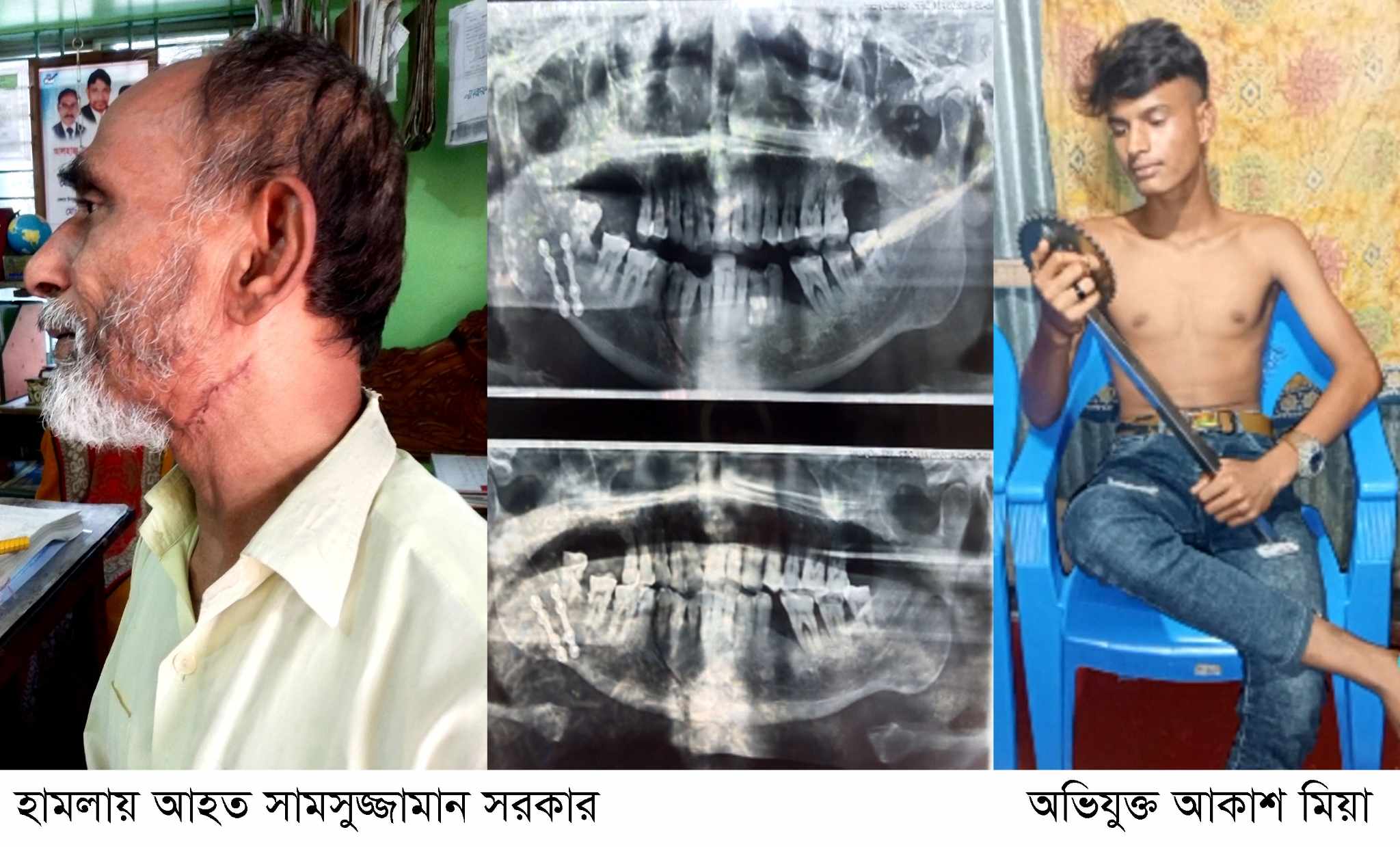 মামলা তুলে আনার জন্য বাদী ও স্বাক্ষীদের প্রাননাশের হুমকির অভিযোগ