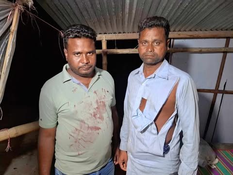চরভদ্রাসনের চরহরিরামপুর আন্ত জেলা ঘাট-ইজাদারদের উপর স্থানীয় সন্ত্রাসীরা অতর্কিত  হামলায় আহত- ৩