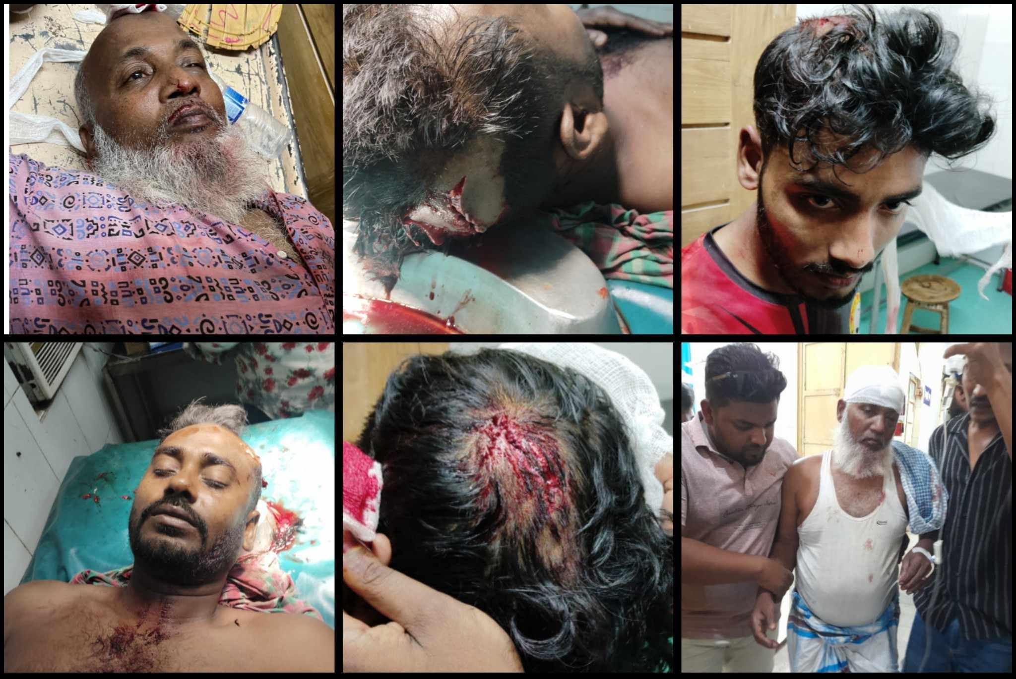 রাজশাহীতে পুকুর জবর দখল ও চাঁদা নিতে আ, লীগ সন্ত্রাসী বাহিনীর হামলা,আহত ৫