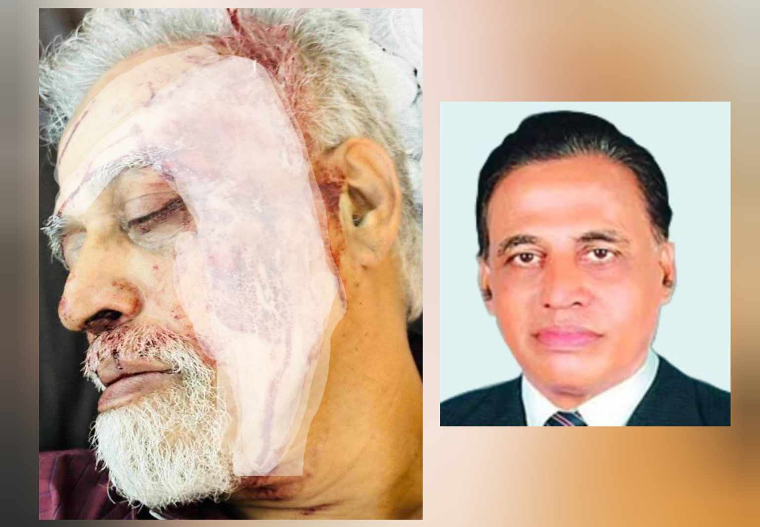 ট্রেন দুর্ঘটনায় রাঙ্গুনিয়ার সাবেক সাংসদ নুরুল আলম আহত