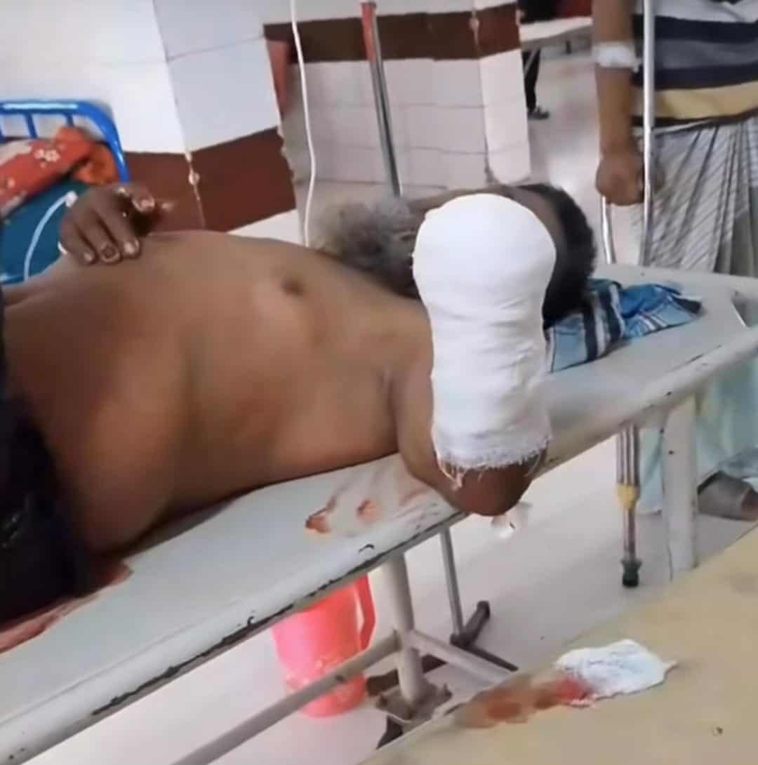 নবীনগরে ভাতিজার দায়ের কোপে চাচার হাতের কবজি বিচ্ছিন্ন