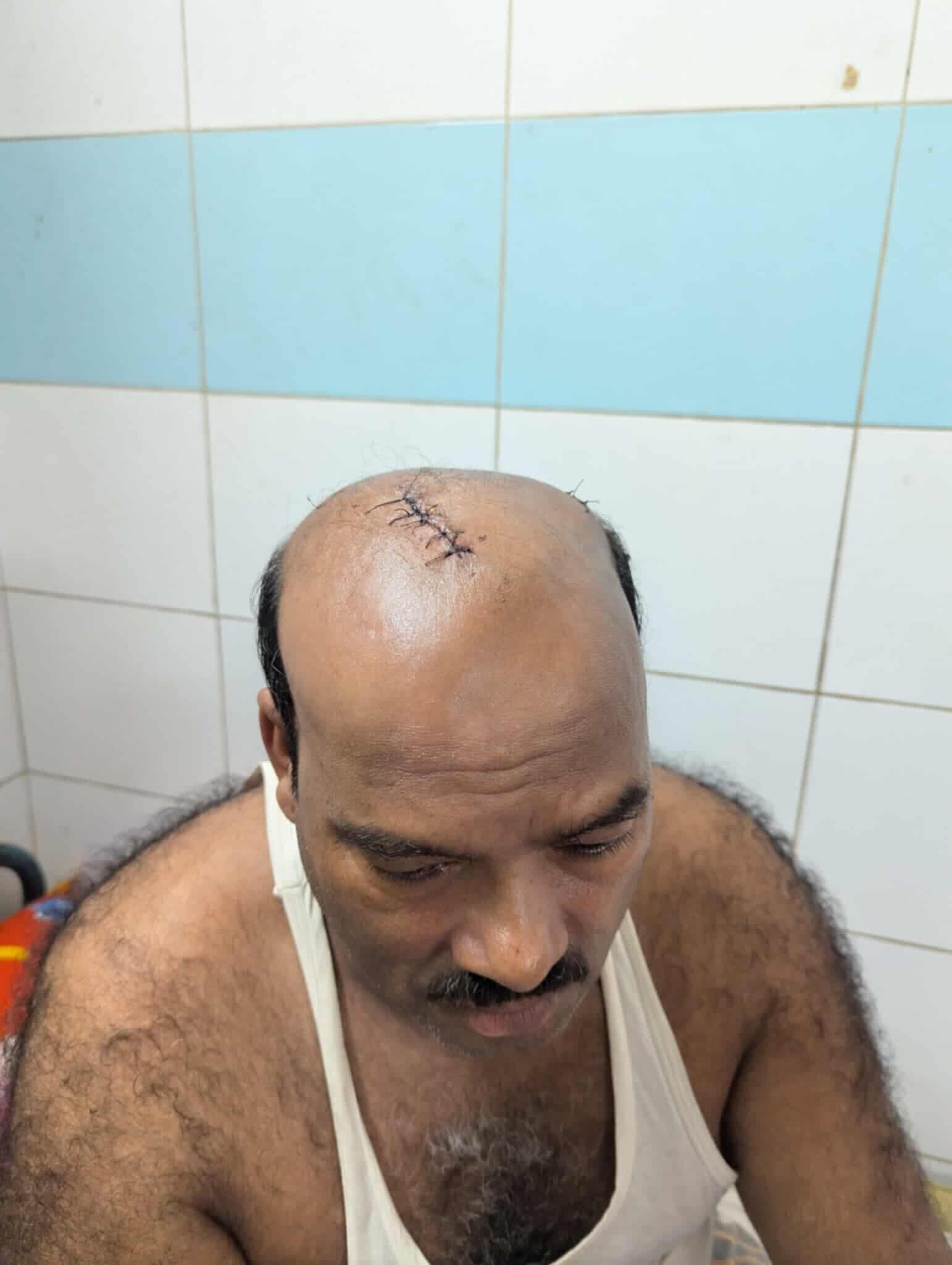 ক্ষমতাবান রাজনৈতিক নেতার পরিবারের দখলবাজি ও হামলায় আহত কৃষক দম্পতি