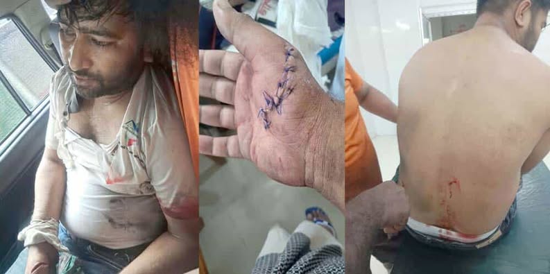 বোয়ালমারীতে মাটি চোরদের হামলায় ইটভাটা ম্যানেজার মারাত্মক আহত