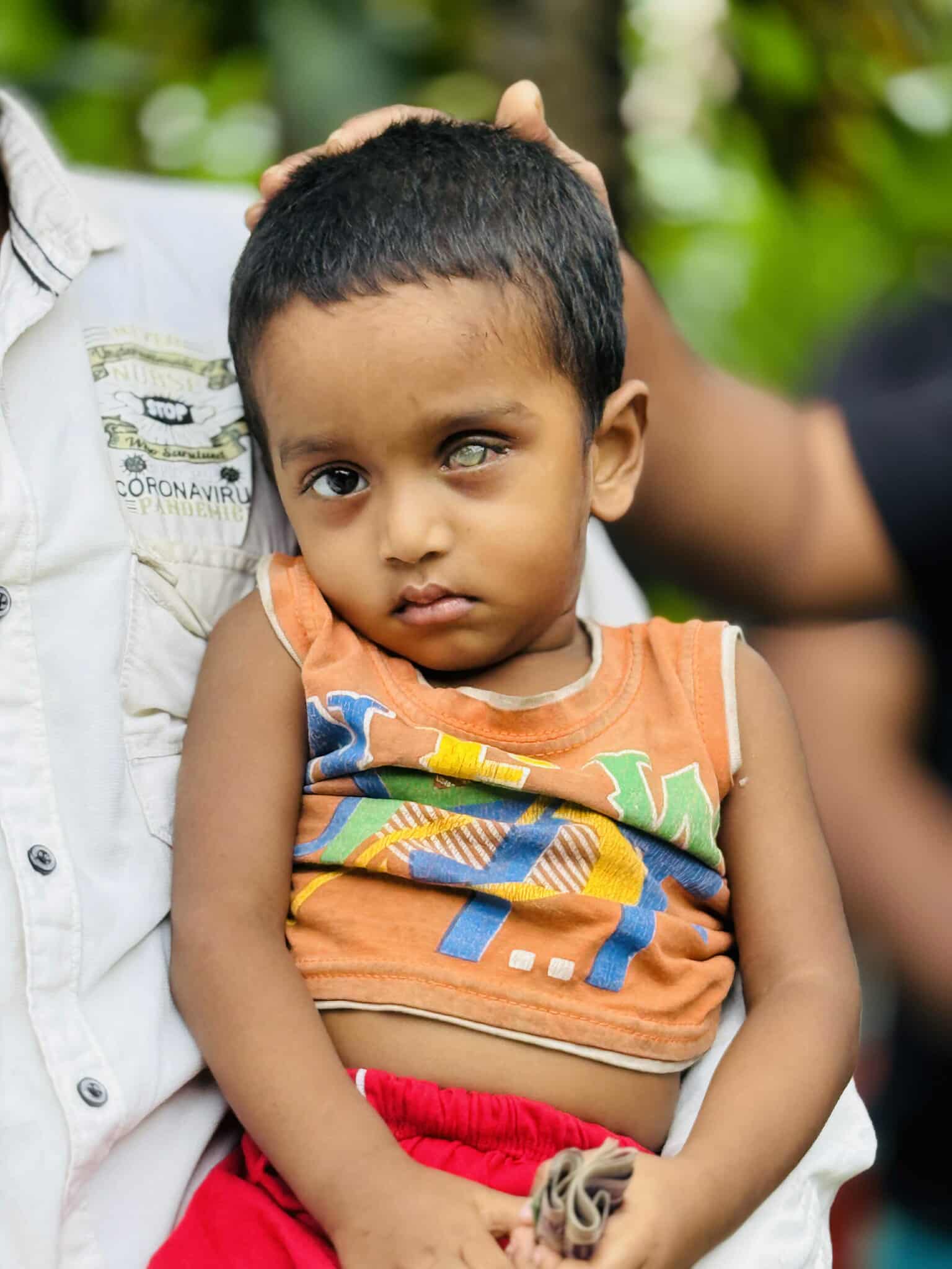চরভদ্রাসনে তিন বছরের শিশু আফজালের চোখের দৃষ্টি ফিরে পেতে সাহায্যের আবেদন