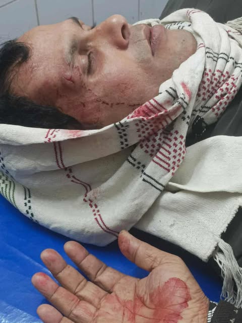 চরভদ্রাসনে ফল ব্যবসায়ীকে পিটিয়ে জখম, চাঁদাবাজির অভিযোগ