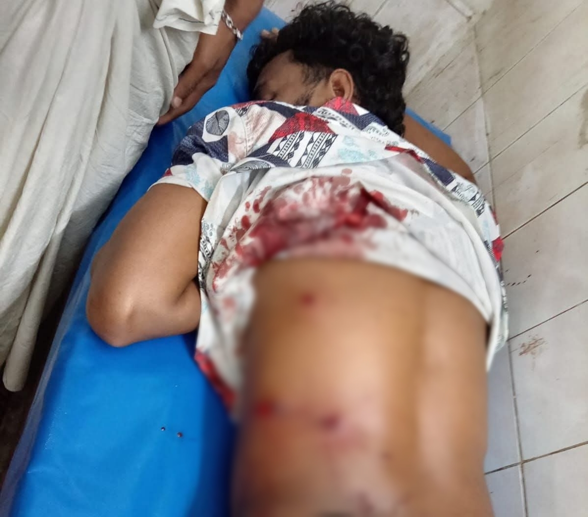 নবীনগরে আধিপত্য বিস্তার ও পূর্ব শত্রুতার জেরে প্রতিপক্ষের হামলায় যুবক গুলিবিদ্ধ