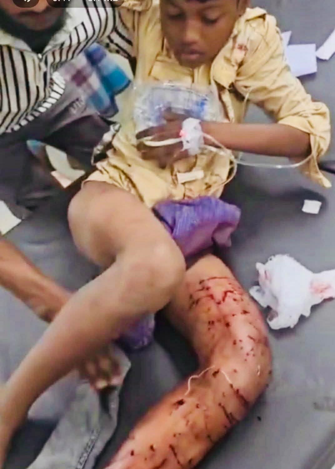 চট্টগ্রামের বাকলিয়ায় সন্ত্রাসীদের দুগ্রুপের গোলাগুলিতে ১২ বছরের শিশু গুলিবিদ্ধ