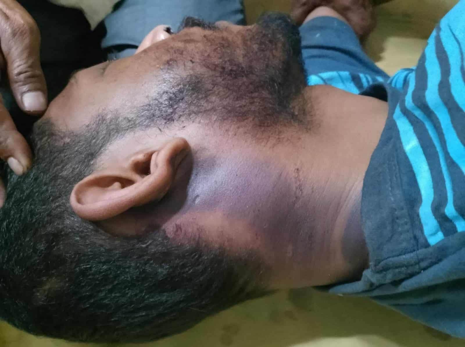 ভূরুঙ্গামারীতে স্ত্রীকে আনতে গিয়ে শ্বশুরবাড়ির লোকজনের নির্যাতন  যুবকের মৃত্যু